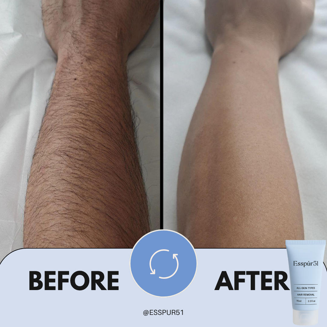 SET C - Hair Removal Cream x3 + Free Aloe Vera x2