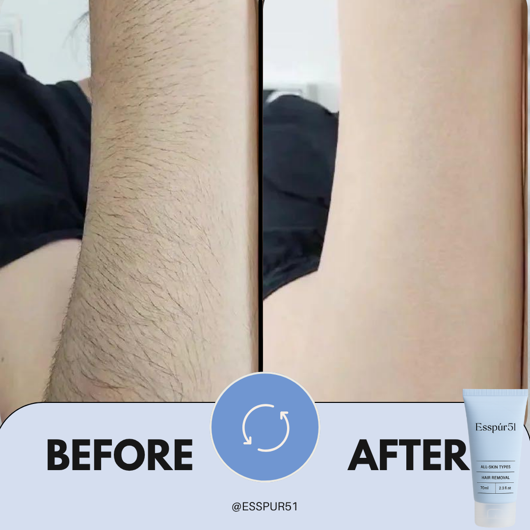 SET C - Hair Removal Cream x3 + Free Aloe Vera x2