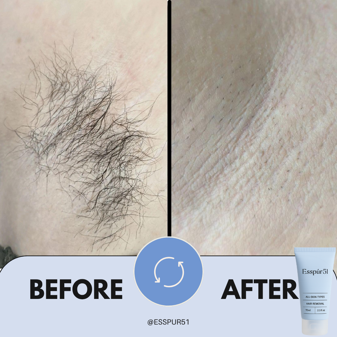 SET C - Hair Removal Cream x3 + Free Aloe Vera x2