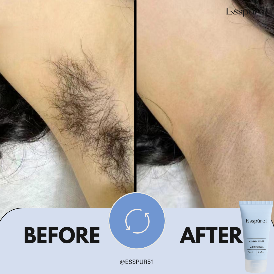 Hair Removal Cream x1
