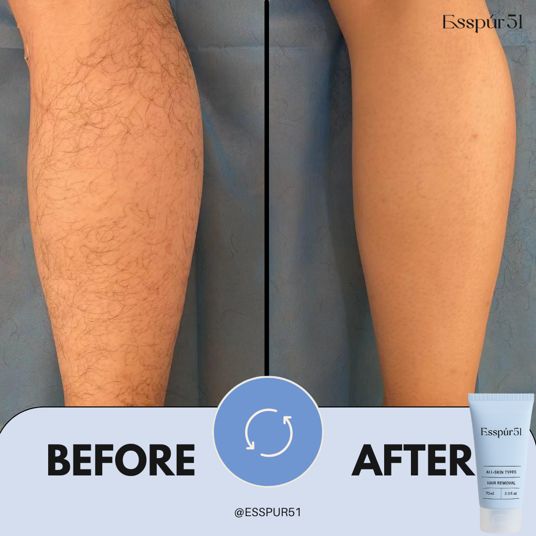 Hair Removal Cream x1