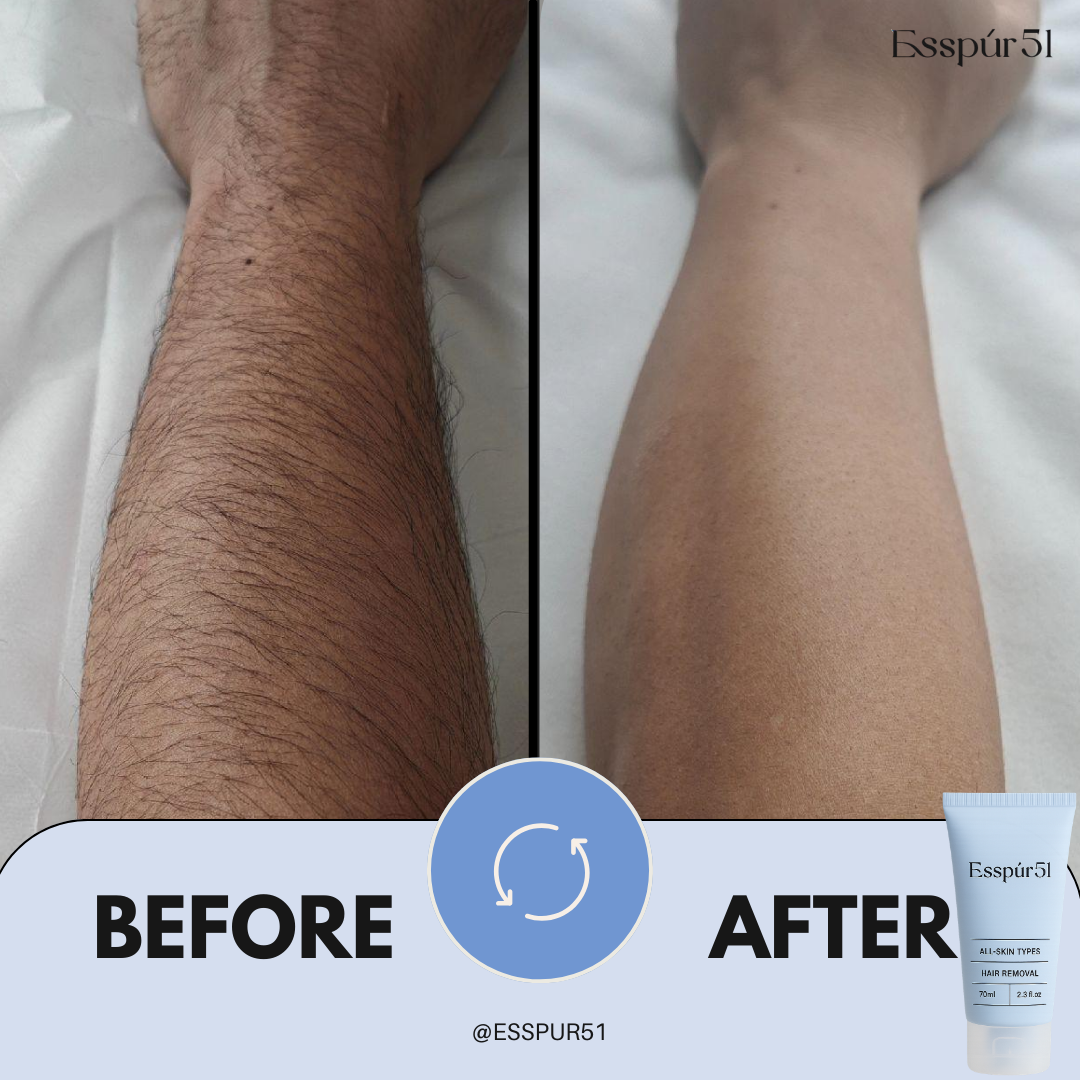 Hair Removal Cream x1
